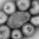 Influenza virus particles.